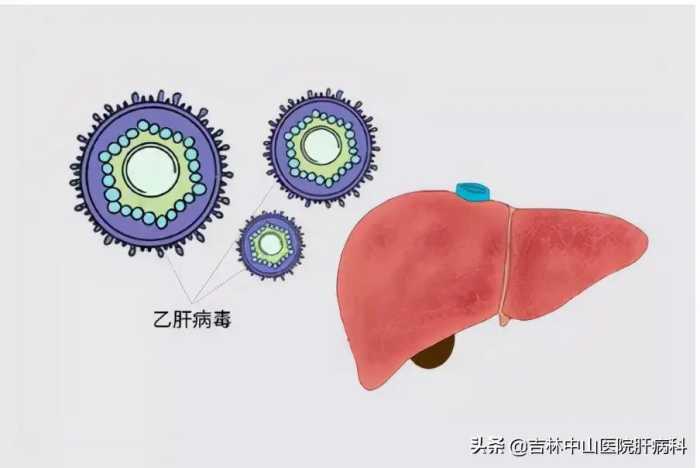 医生提醒：乙肝最佳治疗时机看检查，已经耽误的请别犹豫