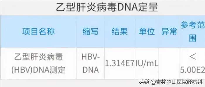 医生提醒：乙肝最佳治疗时机看检查，已经耽误的请别犹豫